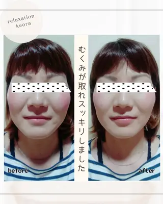 小顔矯正& 慢性肩こり腰痛改善店のエステ・リラクイメージ