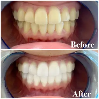 ロング カラー パーマ ヘアアレンジ メンズ キッズ ネイル マツエク・マツパ ライトビューティー 錦糸町店のエステ・リラクイメージ