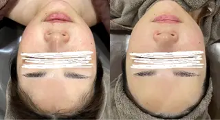 Folche三川町ア ピールポイント確認！のエステ・リラクイメージ