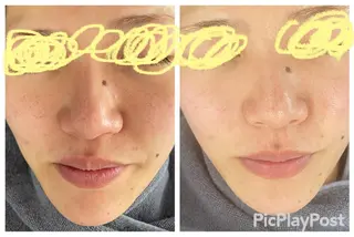 フェイシャルエステ 🌼肌改善🫧のエステ・リラクイメージ