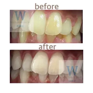 ホワイトニング ショップ船橋２号店のエステ・リラクイメージ