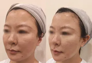 aliaハイフ&水光ジェットサロン所属・aliaハーブ水光店 エステティシャン募集のエステ・リラクイメージ