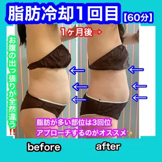 痩身/脱毛/ネイル HARUKAのエステ・リラクイメージ