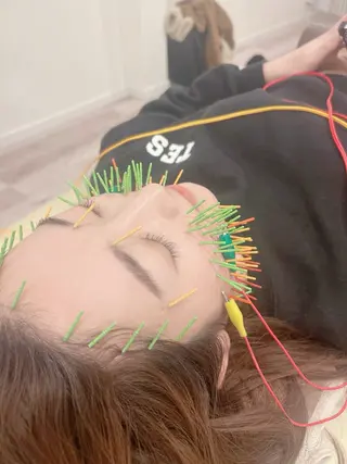 美容鍼灸Solana所属・肌質改善×美容鍼 ゆいのエステ・リラクイメージ