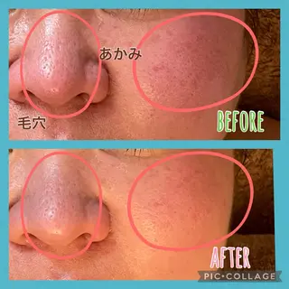 メナードフェイシャルサロン　鏡島精華代行店所属・清水 慎子のその他イメージ