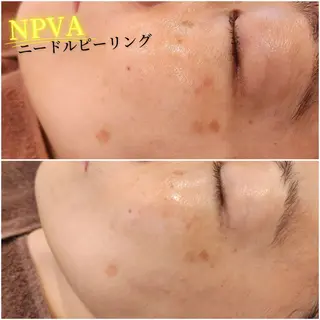 KAUI +所属・KAUI +🌺 Maiのエステ・リラクイメージ