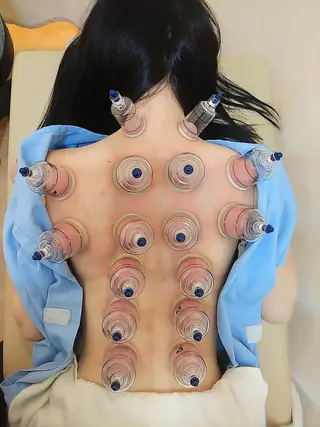 お顔のむくみたるみ 専門☆美容鍼小顔矯正のエステ・リラクイメージ