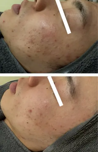 NHerb【エヌハーブ】所属・横田 汐里のエステ・リラクイメージ