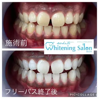 ネイル マツエク・マツパ アイブロウ ホワイトニング&アイラッシュ四日市ホワイト所属・アイラッシュ ホワイトニング四日市のマツエク・マツパデザイン