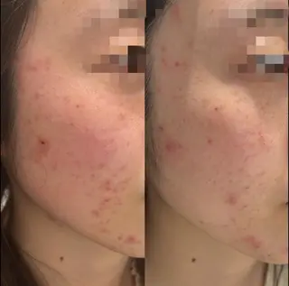 POLA THE BEAUTYカトオノのエステ・リラクイメージ