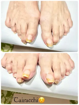 ネイル Tairacchi ﾀｲﾗｯﾁのエステ・リラクイメージ