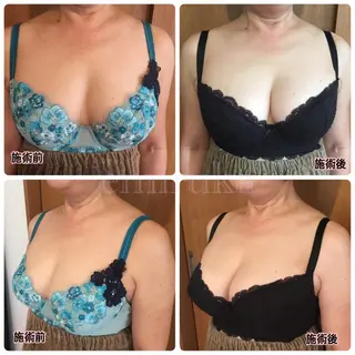 バストサロン emiruka所属・バストアップサロン エミルカのその他イメージ