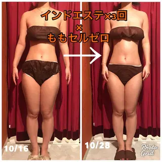 Cielo(シエロ) ダイエット専門店のエステ・リラクイメージ