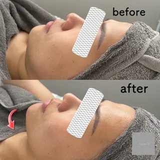 marron所属・痩身ハイパーナイフ ララピールリアボーテのエステ・リラクイメージ