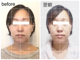 小顔矯正ドライヘッド Arincoのエステ・リラクイメージ