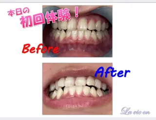 セルフホワイトニングサロン　ラヴィアン所属・ホワイトニングサロン La vie enのその他イメージ