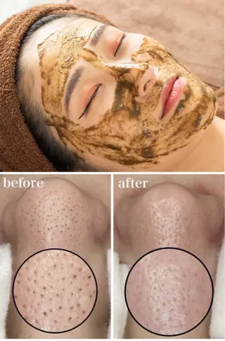 REMENTE池袋東口店所属・REMENTE🪞 KANAのエステ・リラクイメージ