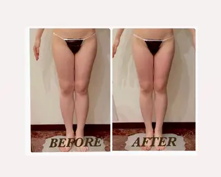 Prima〜プリマ〜 名古屋駅店所属・Prima 痩身脱毛 にごうかおりのエステ・リラクイメージ