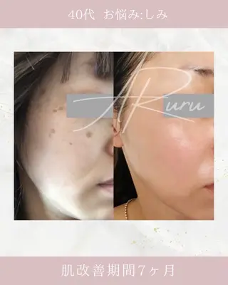 ARuru所属・ARuru 本店のエステ・リラクイメージ