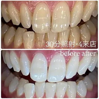 メンズ ホワイトニングルーム　川崎店所属・ホワイトニング ルーム　川崎店のその他イメージ