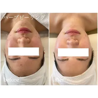 I'm -ｲﾑ-所属・肌質改善／ブライダル I'm.-イム-のエステ・リラクイメージ