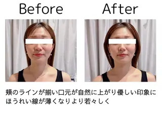 鍼灸院olina所属・鍼灸師 NARUMIのエステ・リラクイメージ