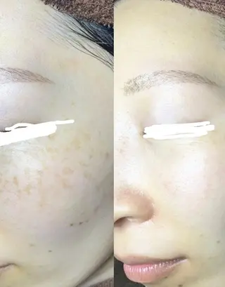 大阪守口市【シミ専門】Peach所属・【シミ専門サロン】 Peachのエステ・リラクイメージ