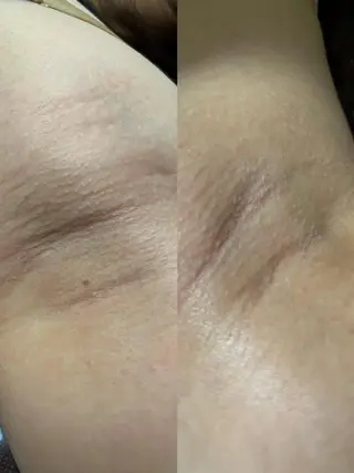 うえつま ふみえのエステ・リラクイメージ