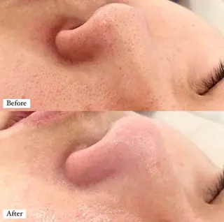 Hi Beauty 渋谷(ネイル、ハイパーナイフ6、脂肪れいきゃく、マッサージ＆エステサロン)所属・Hi beauty 渋谷のネイルデザイン