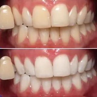 WhiteningSquare by Avanti所属・ホワイトニングスクエ ア by アバンティのその他イメージ