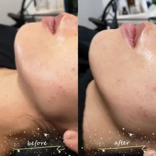 🅖🅤🅩🅔🅛 salonのエステ・リラクイメージ