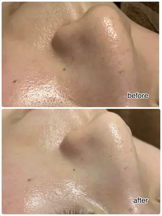 ENCHANT 脱毛.小顔.毛穴のエステ・リラクイメージ