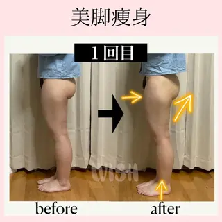 WISH 美肌脱毛のプロ！須藤のエステ・リラクイメージ