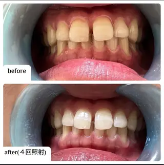 メンズ ☀️Akala☀️ メンズ脱毛のエステ・リラクイメージ