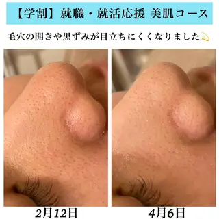 Bellesthe （ベルエステ）のエステ・リラクイメージ