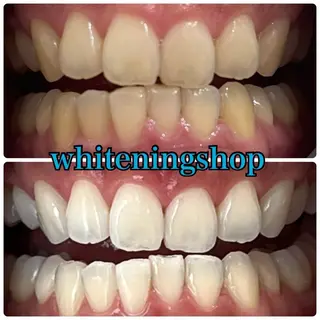 メンズ ホワイトニング ショップ川越店のエステ・リラクイメージ