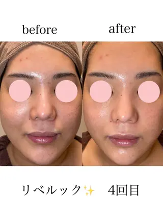 コンセプトサロン友所属・コンセプトサロン友 かすみのエステ・リラクイメージ