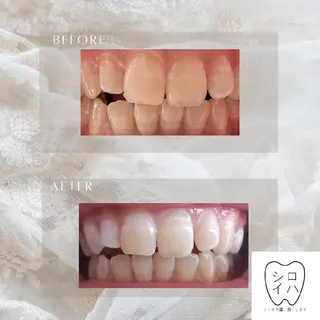 ホワイトニングサロン シロイハ所属・歯を白くしたい方🦷 シロイハのその他イメージ