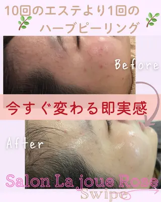 ｍｉkｉ 東根の肌質改善サロンのエステ・リラクイメージ