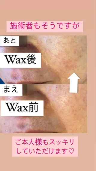 産毛専門店 Bittoのエステ・リラクイメージ