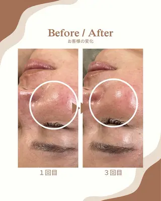 1st｜フェイシャル エステ専門店のエステ・リラクイメージ