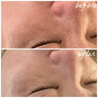 メンズ メナード岐阜市茜部 杉浦のエステ・リラクイメージ