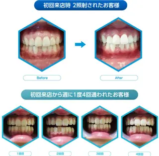 Venus Beauty銀座のマツエク・マツパデザイン