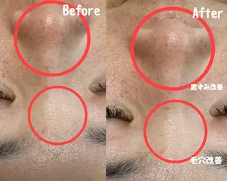 Surien 水脇ゆうのその他イメージ