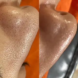 Mandarin Orange所属・毛穴から始める肌メン テマンダリンオレンジのエステ・リラクイメージ