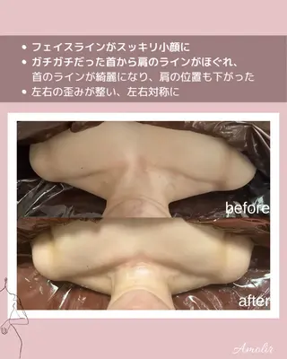 30代以降のボディ メイク Amolirのエステ・リラクイメージ