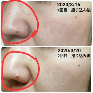 未病ケアサロン　EMINY所属・未病ケアサロン EMINY☺︎勝俣のエステ・リラクイメージ