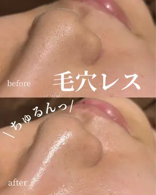 HINANO矢場町店【ヒナノ】所属・脱毛/肌改善🌿 HINANO 村田のエステ・リラクイメージ