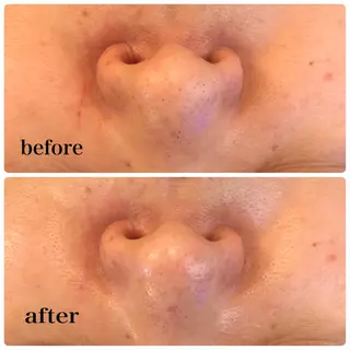 Salon de cheri サロンドシェリ人形町店所属・毛穴のお悩み・シミ 松本瞳のエステ・リラクイメージ