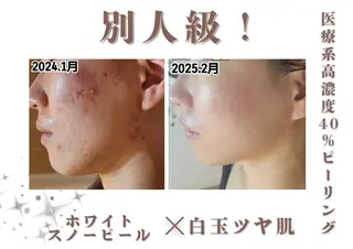 🎀美肌ケアサロン 🎀レイビス銀座店のエステ・リラクイメージ